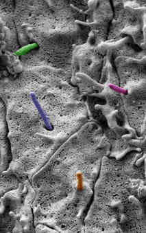 Scanning electron microscopy of primary cilia extending from the ventral neuroectoderm. Primary cilia are pseudo colored for emphasis.